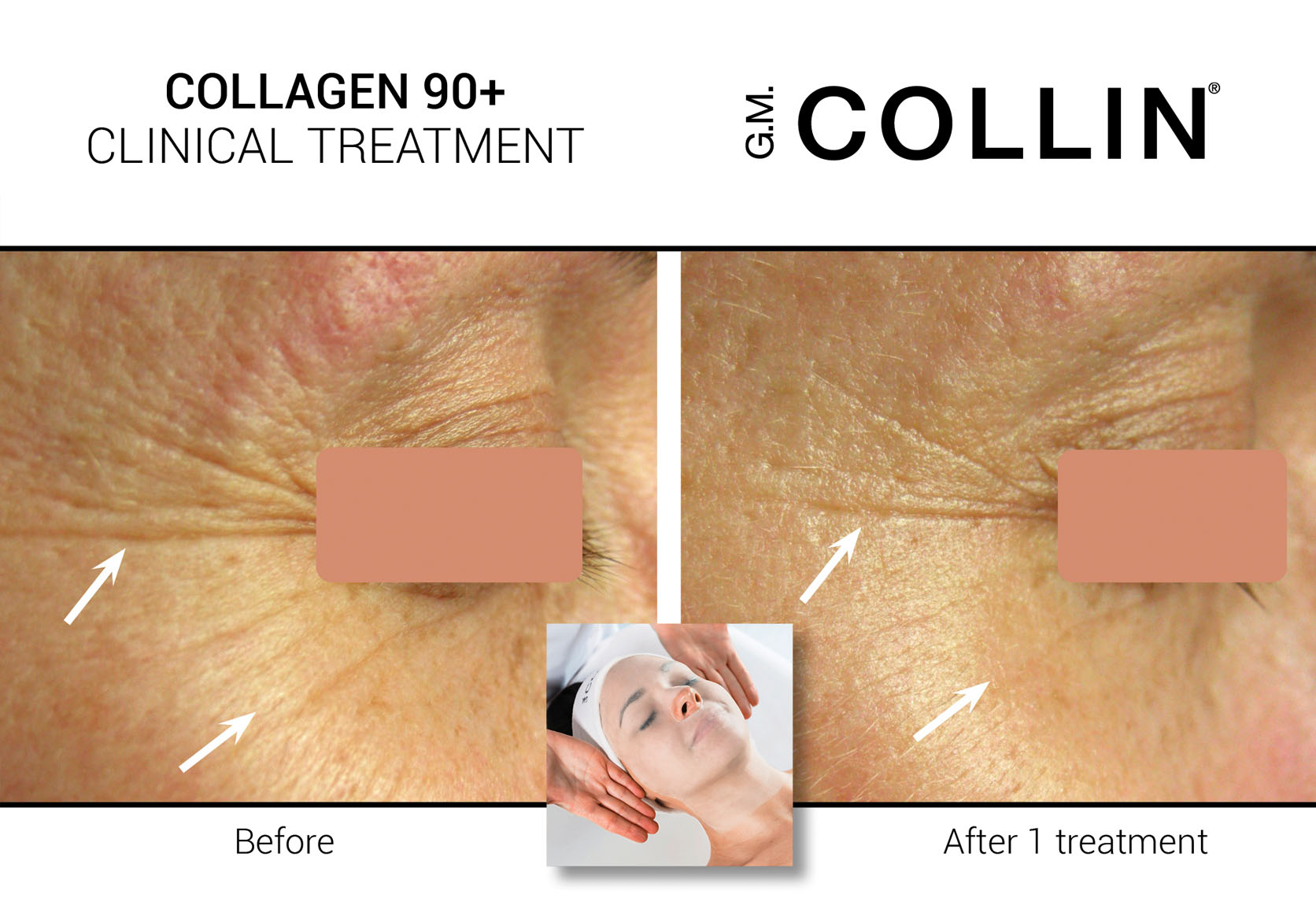 facial-collagen-90+