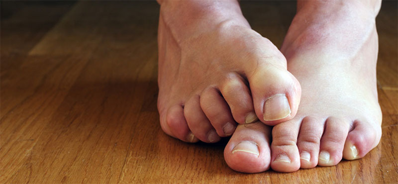 men's toenail treatment